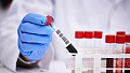 Медицинские анализы Медицинские анализы